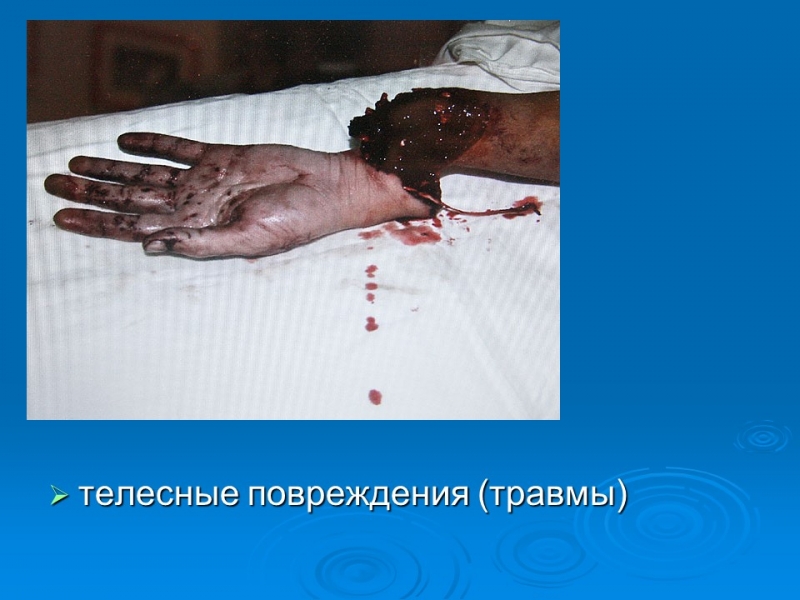 Трудовой кодекс и меры ответственности за несчастные случаи